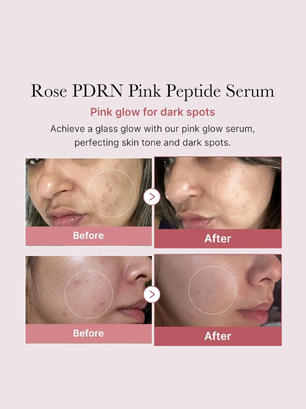 PDRN Pink Peptide Serum by Medicube